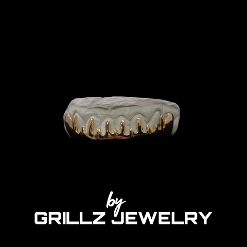 Stylish and durable gold grillz, expertly made for the modern individual.