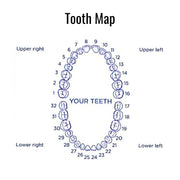 Diagram of a tooth map with numbered teeth on a white background