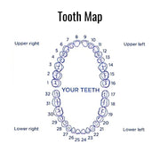 Diagram of a tooth map with numbered teeth on a white background