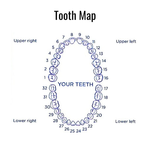 Diagram of a tooth map with numbered teeth on a white background