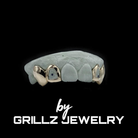 High-Quality Gold Grillz crafted with precision and care.
 