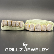 High-Quality Gold Grillz crafted with precision and care.