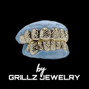 High-Quality Gold Grillz crafted with precision and care.