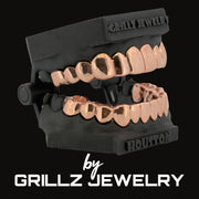Rose gold grillz on black case with 'Grillz Jewelry' branding on a black background