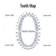 Diagram of a tooth map with numbered teeth on a white background
