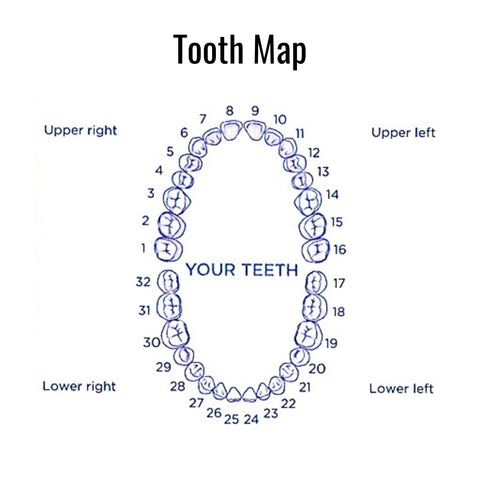 Diagram of a tooth map with numbered teeth on a white background