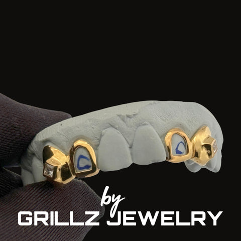 Grillz with gold and blue accents on a black background, featuring the brand 'Grillz Jewelry'.