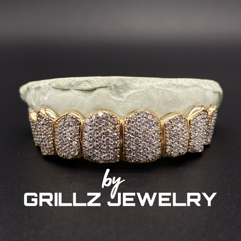 Handcrafted gold grillz that elevate your personal style with a touch of luxury.
