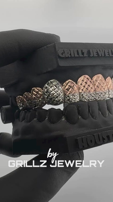 Before/after dental impression for perfect-fitting two-tone diamond grillz