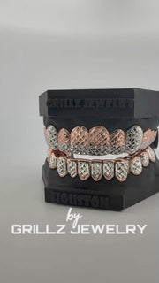 Custom rose gold frame grillz with diamond accents - luxury pink-toned dental jewelry