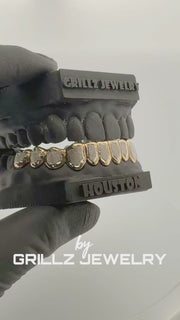 Custom Yellow Gold Grillz with White Diamond Dust - Luxury Contrast Dental Jewelry