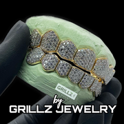 Icedout diamond grillz